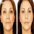 جوانسازی صورت (چهره) و بدن در مرکز پزشکی نشاط
