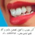 خدمات دندانپزشکی زیبایی سفید کردن دندان طراحی لبخند ها